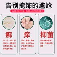 喷剂脚臭皮皮皮肤喷雾肤净剂