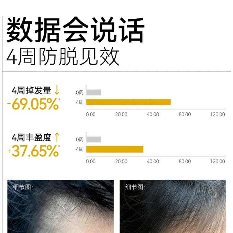 长发小寨 非遗固发防脱洗发水400ml 淘米水防断掉发男女士通用高清大图