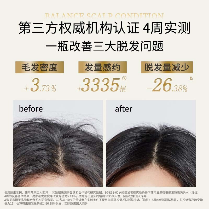 滋源强根健发防脱洗头水(油性)400ml*2高清大图