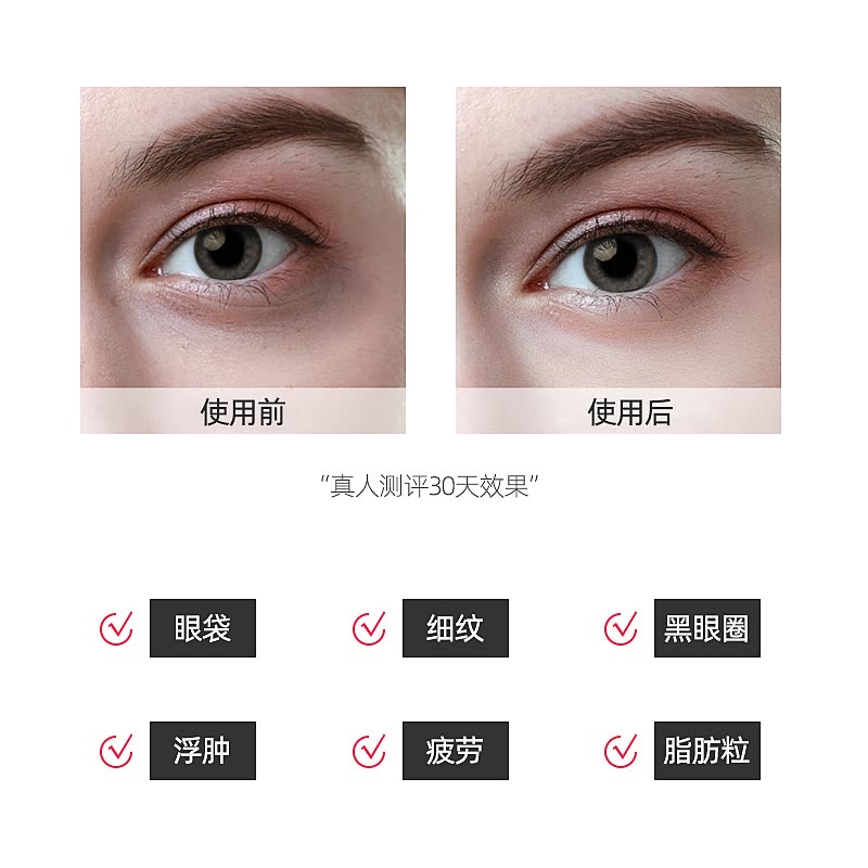 Marasil眼部ems微电流美容仪家用导入仪脸部提拉紧致按摩仪美眼仪 价格图片品牌报价 苏宁易购marasil美容仪旗舰店