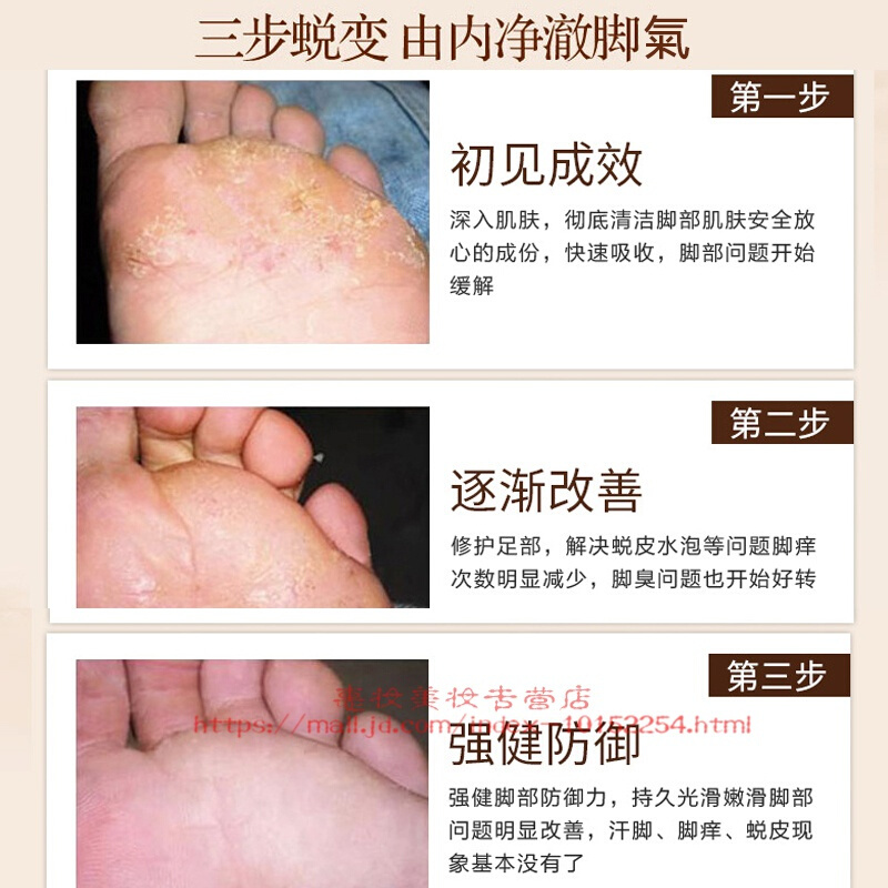 马油膏皲裂膏防干裂修护痒脱皮原装脚后跟清足霜*3瓶wroda