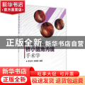 桥小脑角内镜手术学