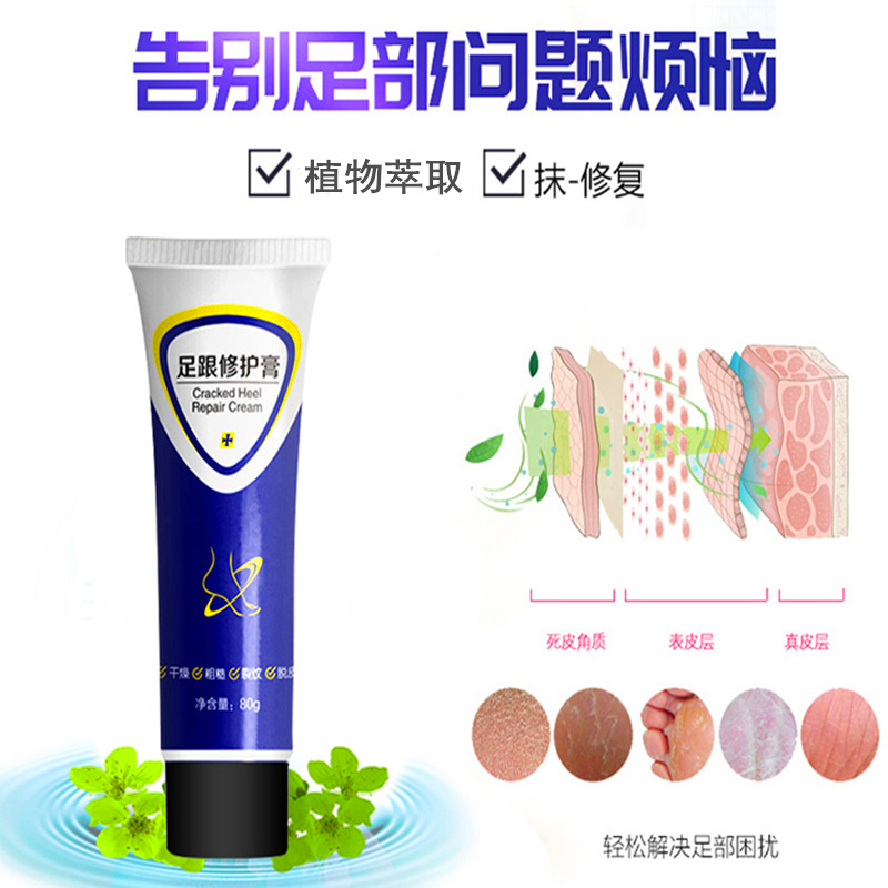 金丫足跟修护膏足霜改善脚痒脱皮开裂水泡粗糙老茧现象80g/支高清大图