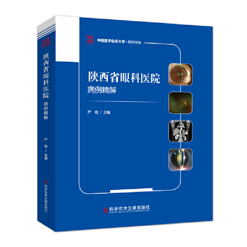 醉染图书陕西省眼科医院病例精解9787518972074高清大图