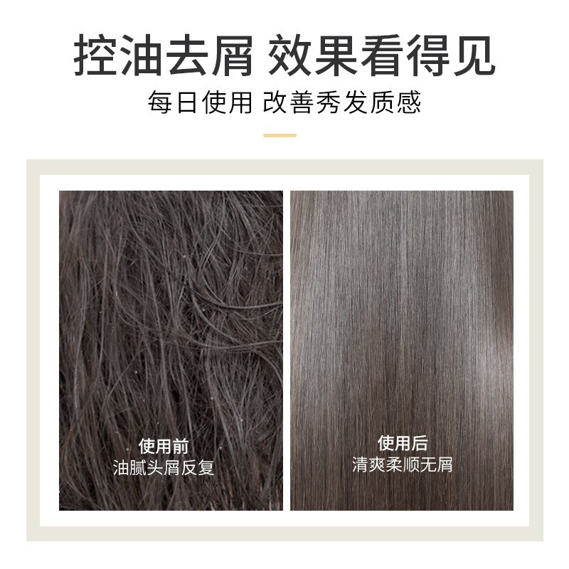 浅香(ASAKA)青春版-扁柏氨基酸洗发乳750g(单位:件)高清大图