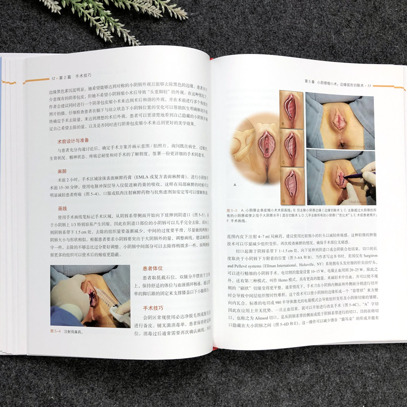 [正版] 女性外阴术 概念分类及手术技巧 美容外科 私密手术照片演示视频 从业人员参考阅读 上海科学技高清大图