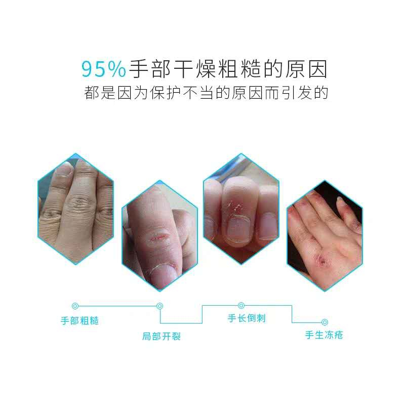 隆力奇蛇油护手霜120g滋润保湿补水秋冬防冻防脚后跟干裂男女
