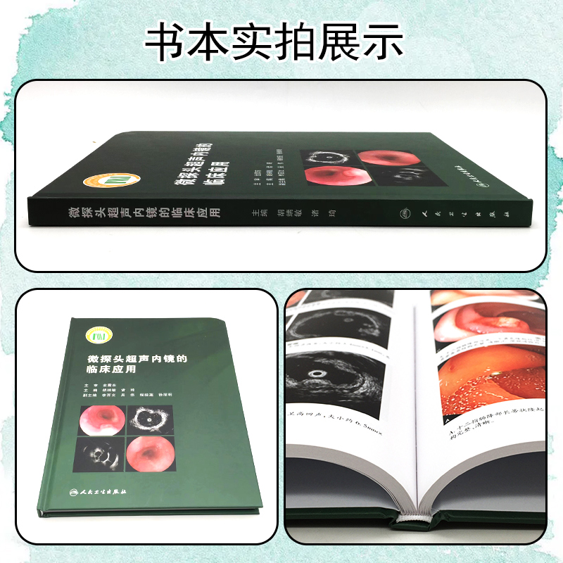 [正版] 微探头超声内镜的临床应用胡端敏诸琦主编真实临床病例超声基本原理内窥镜检超声波诊断内科学 人民卫生出版社978高清大图