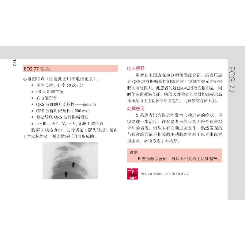 醉染图书轻松解读心电图(第5版)9787565926259高清大图