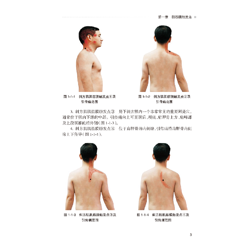 醉染图书阿是穴今释·软组织疼痛治疗点临床应用9787117338高清大图