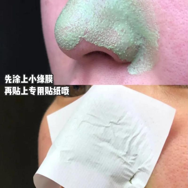 去黑头小绿膜套盒[1盒装] 去黑头粉刺螨虫学生女清洁收缩毛孔吸出黑头神器鼻贴膜黑头贴套装