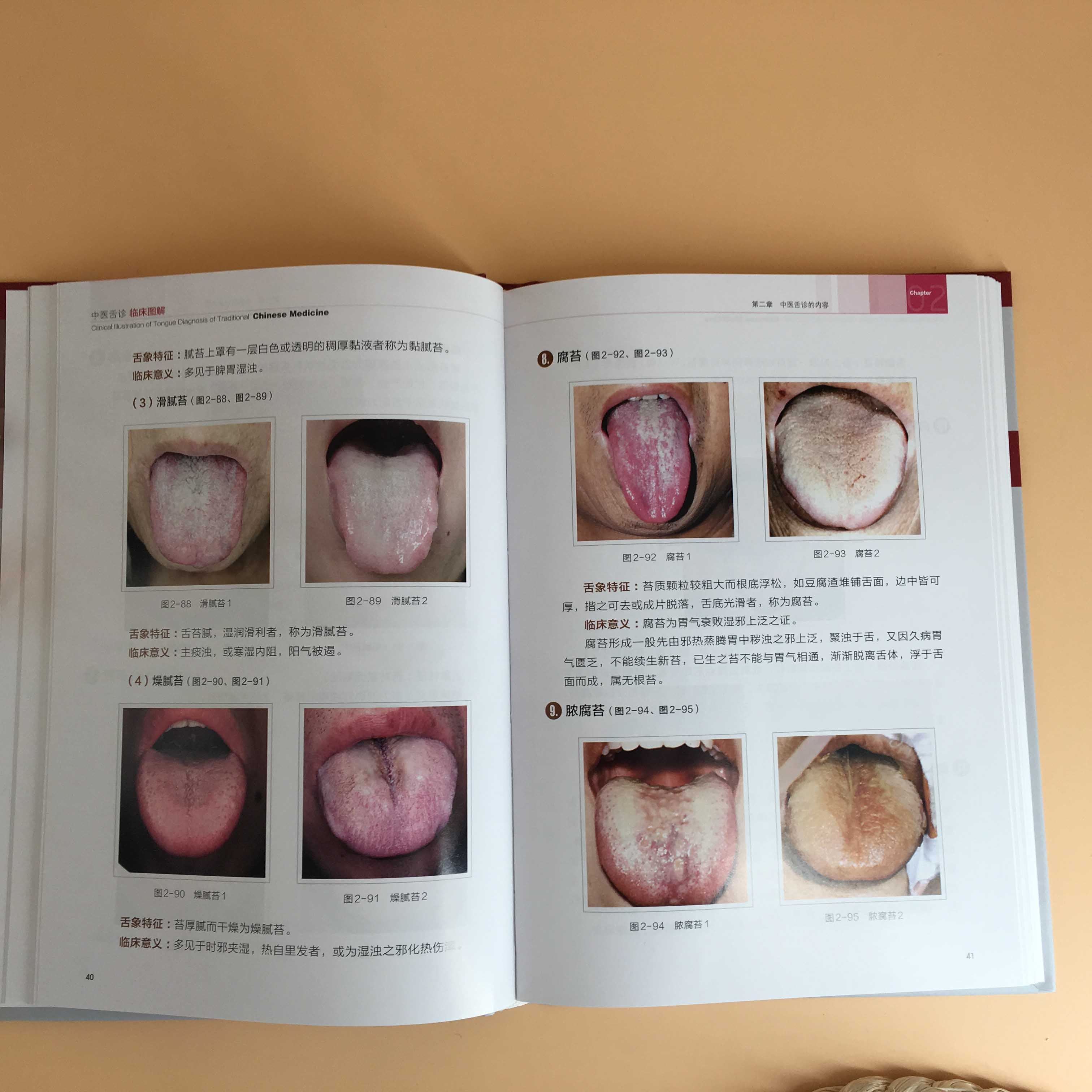 2册 临床实用舌象图谱+观舌配方 [正版] 中医舌诊临床图解 许家佗 舌诊基础知识 舌的组织结构 舌面脏腑分属理论 望舌高清大图