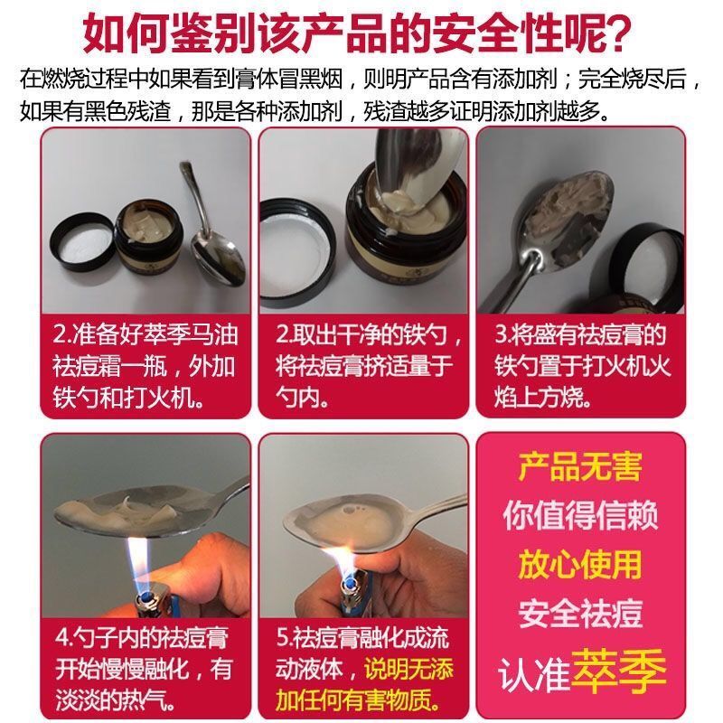 快速祛痘膏男女学生祛痘印产品去痘印修复痘坑青春痘去痘痘膏套装 (轻度)祛痘