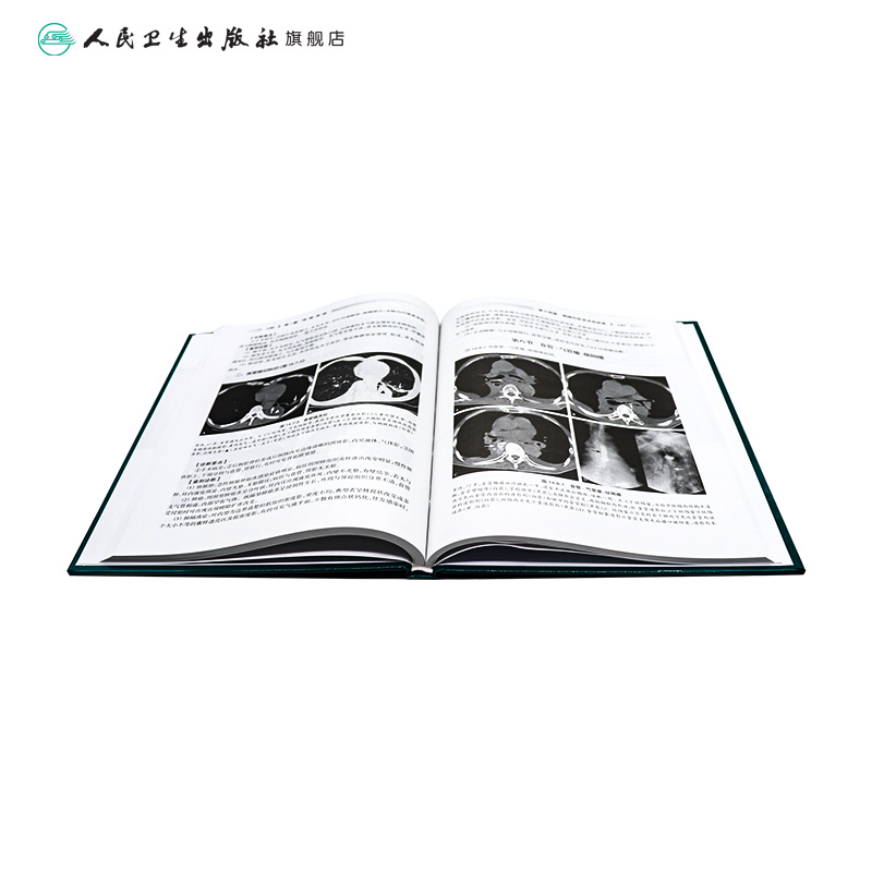 [正版]医学影像学读片诊断图谱胸部分册 头颈胸腹骨肌部放射医学超声诊断学影像解剖学胸部影像学x线读片指南磁共振ct诊断高清大图