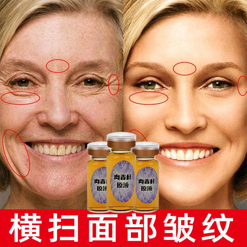 肉毒杆原液祛鱼尾纹法令纹抗衰提拉紧致提升抗皱抗衰涂抹肉毒精华 一瓶测试(不推荐)
