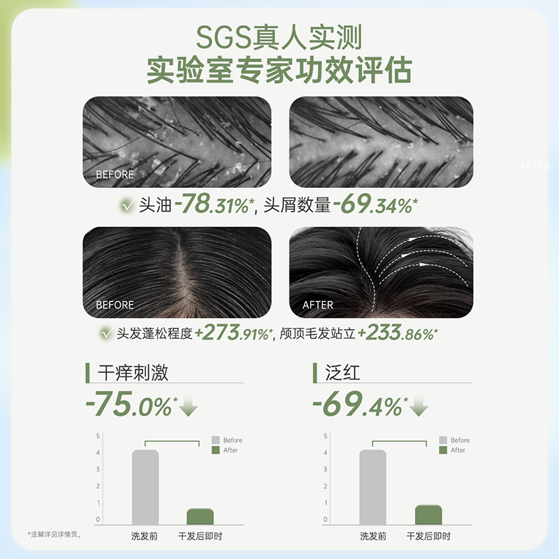 袋鼠妈妈青少年去屑控油洗发水(清新白茶)-380ml-D高清大图