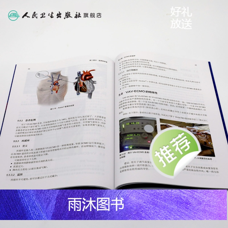[正版]体外膜肺氧合监测和护理尚游黄海燕体外反搏心力衰竭呼吸与危重症医学ECMO呼吸内科学内科护理人民卫生出版社内科学高清大图
