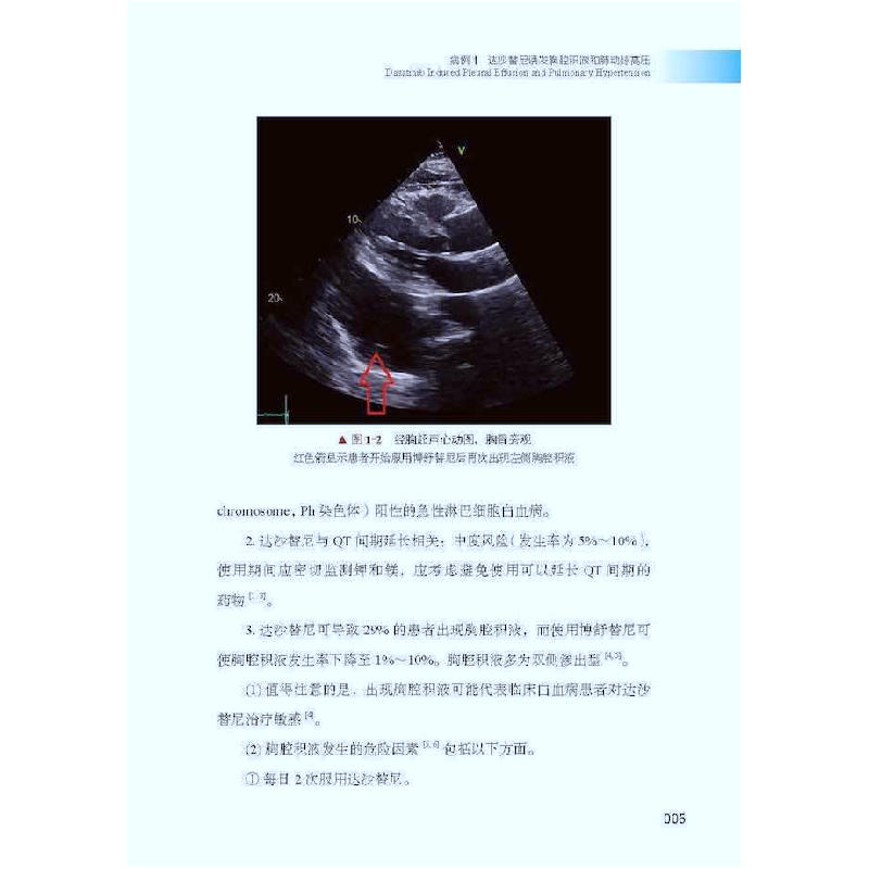 正版新书]肿瘤心脏病学临床病例集[加]Atooshe Rohani9787504694高清大图