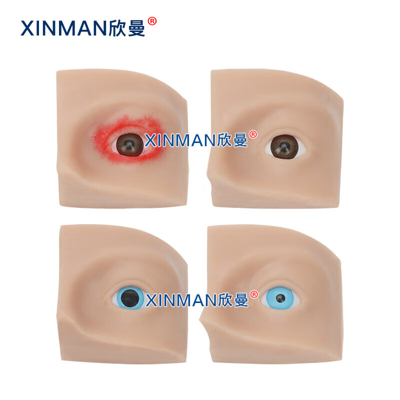 欣曼科教 人员中毒仿真模型 神经性中毒 芥子气中毒 路易氏剂中毒 教学用模型XM-SQ16A高清大图