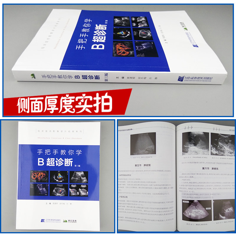 [醉染正版]临床医师影像手把手教你学 B超诊断 第三版 医学影像图谱 超声诊断学书籍 超声图像及鉴别诊断 超声检查技术手高清大图