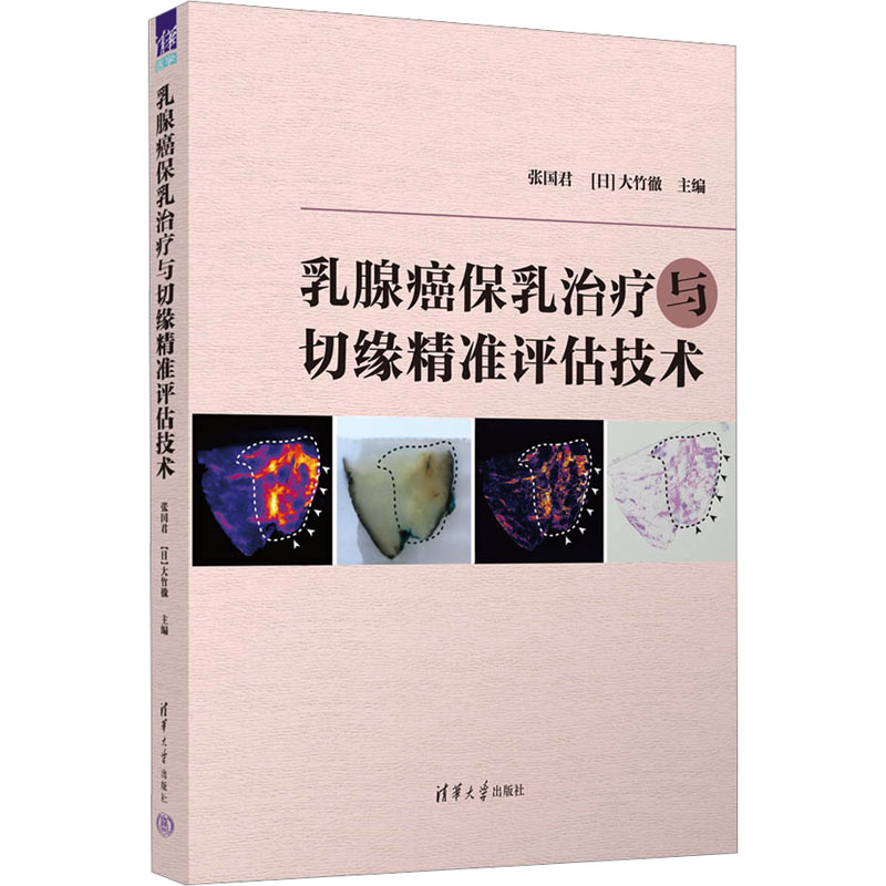 【M】乳腺癌保乳治疗与切缘精准评估技术-9787302644217
