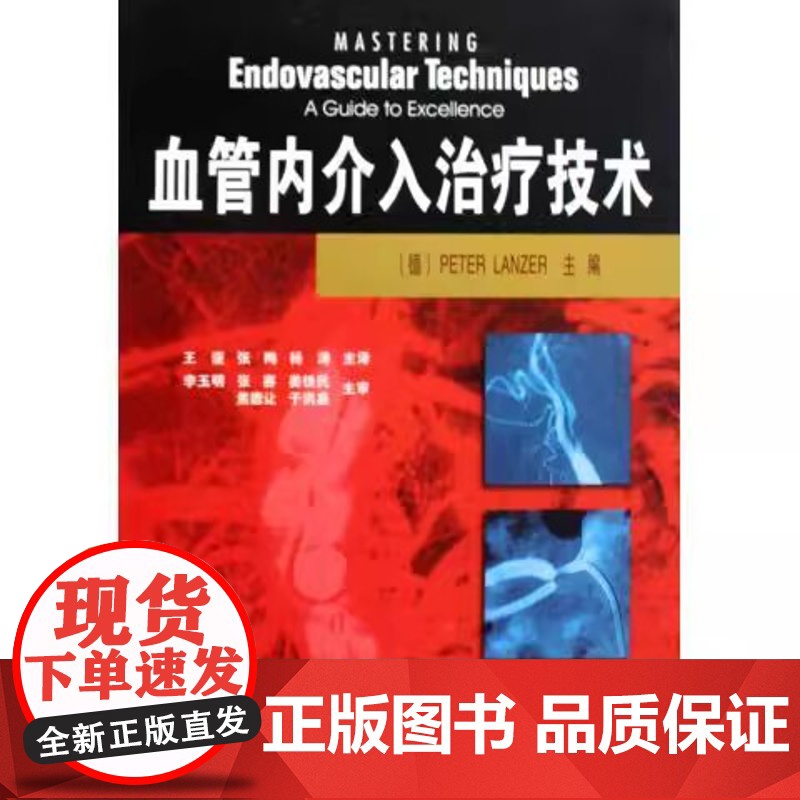 血管内介入治疗技术高清大图