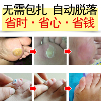 广雅瘊疣平鸡眼贴膏效特肉刺手足成人去疣灵去除跖疣瘊子液脚垫老茧贴尤寻常疣趾疣扁平疣病毒丝状疣祛疣康瘊疣净肉刺猴克疣液必治