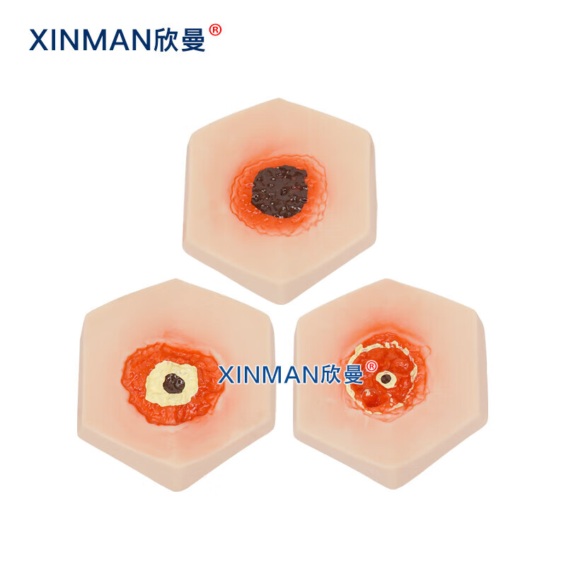 欣曼科教 阶段褥疮护理模型 压疮护理仿真模型XM-H91高清大图