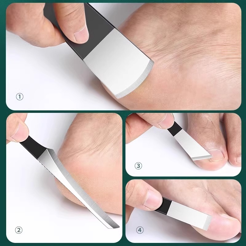 修脚刀具套装专业足疗技师用扬州三把刀剪指甲刀炎甲沟专用工具钳高清大图