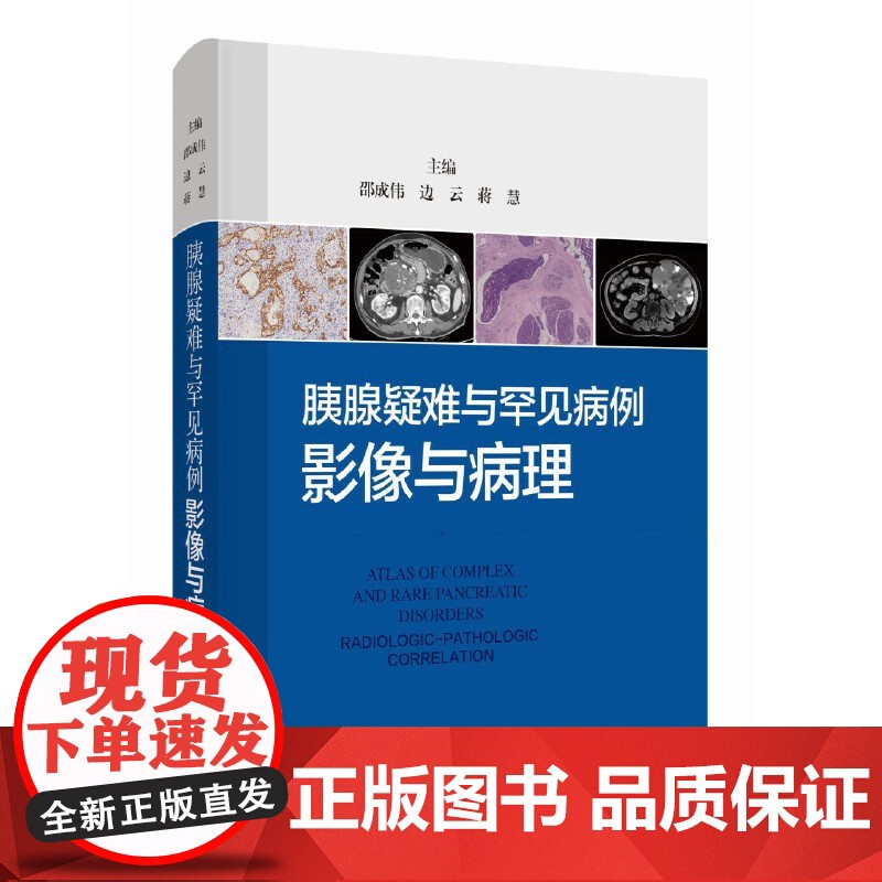 胰腺疑难与罕见病例:影像与病理高清大图