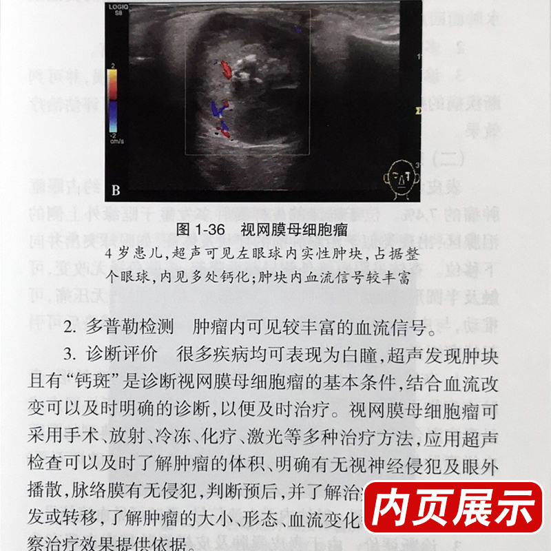 [正版] 中国浅表器官超声检查指南 中国医师协会超声医师分会指南丛书 人体组织学 超声波诊断 人民卫生出版社978高清大图
