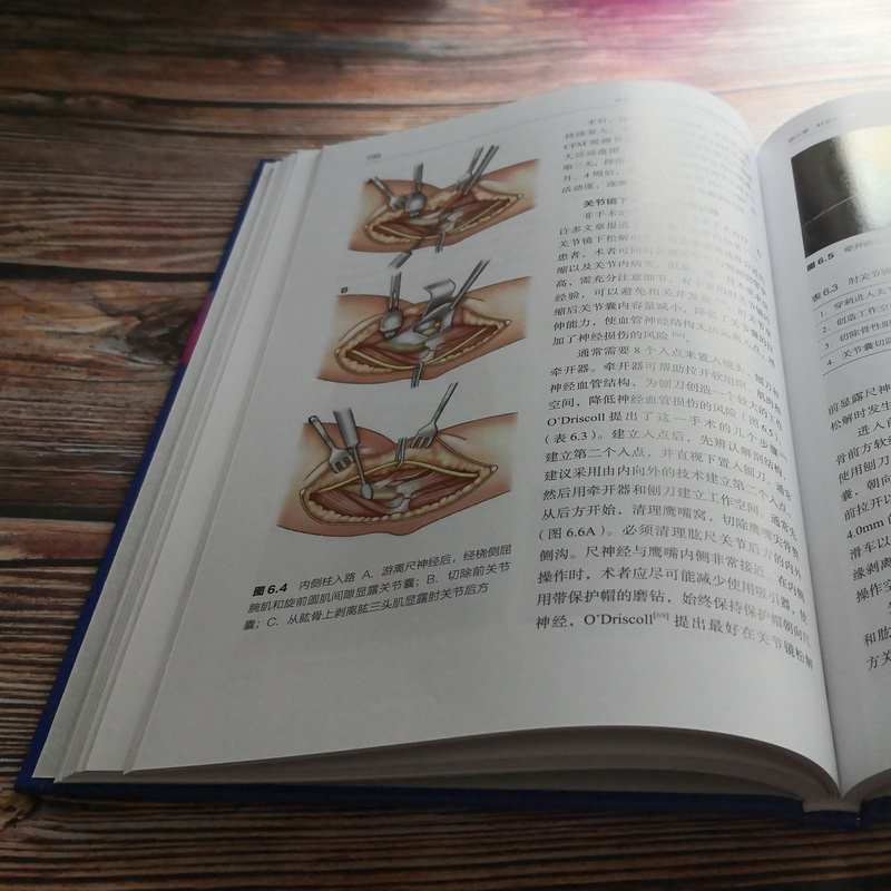 醉染图书肘关节手术精要9787571405441高清大图