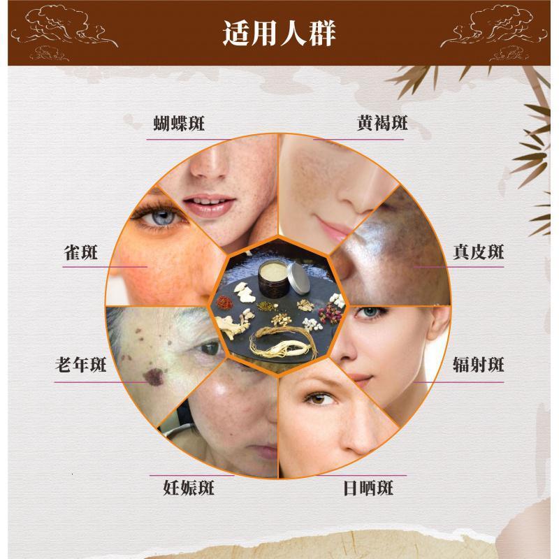 七子白中药面膜粉淡斑祛斑去醋疗珍珠粉泥院专用视频