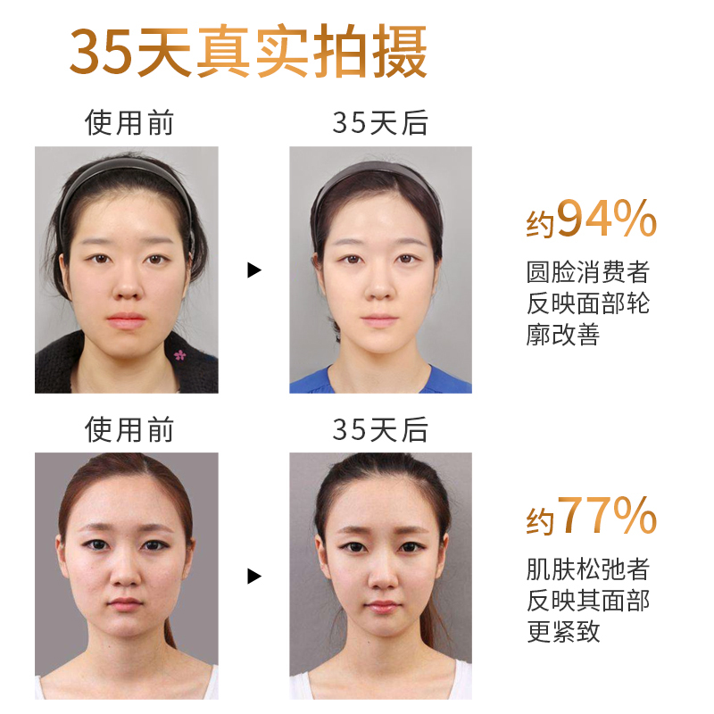 美技瘦脸神器瘦脸仪v脸提拉紧致溶脂瘦双下巴女法令纹神器脸部美容仪