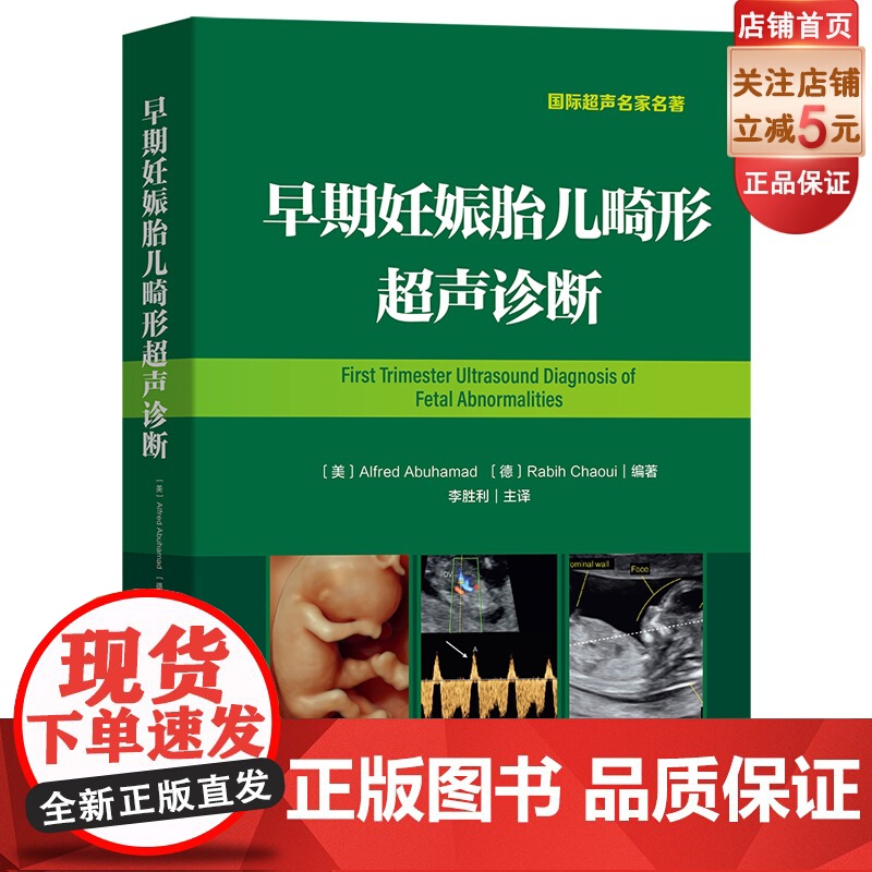 早期妊娠胎儿畸形超声诊断(李胜利主译 早孕期胎儿畸形超声诊断书)高清大图