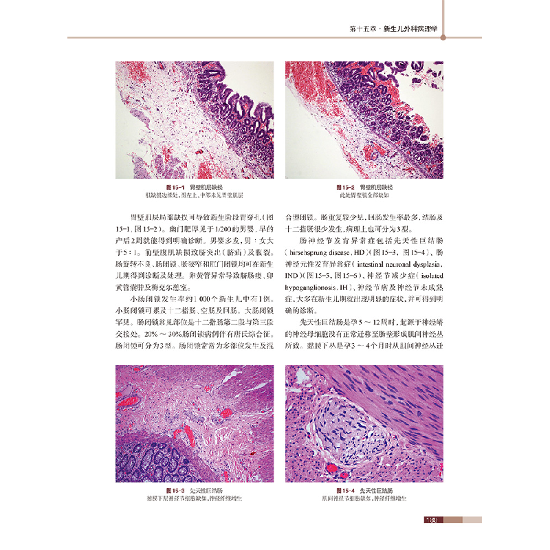 醉染图书新生儿外科学(第二版)9787519262471高清大图