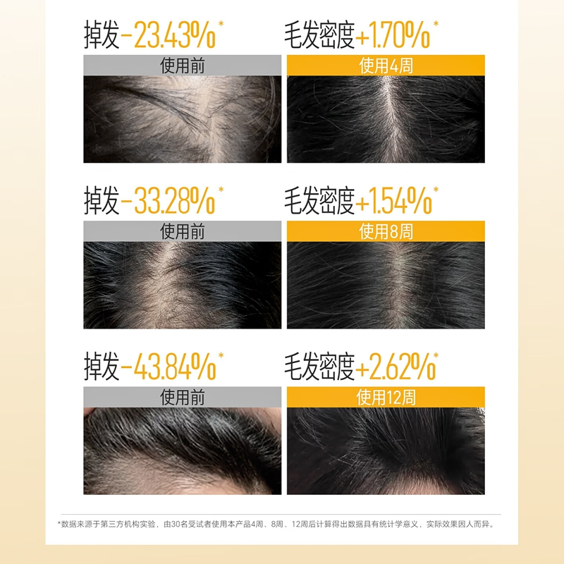 三个魔发匠防脱精华 洗发乳(圆瓶)400ml高清大图