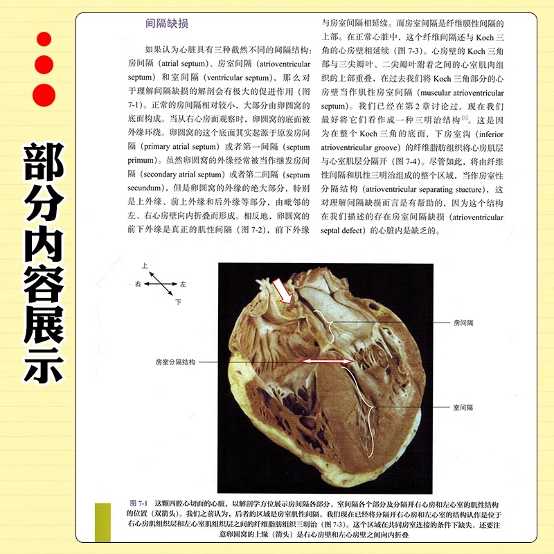 [正版]书WILCOX心脏外科解剖学 临床医学 西医 心脏外科解剖类图书中的经典著作 夏宇 译 上海科学技术出版社书籍高清大图
