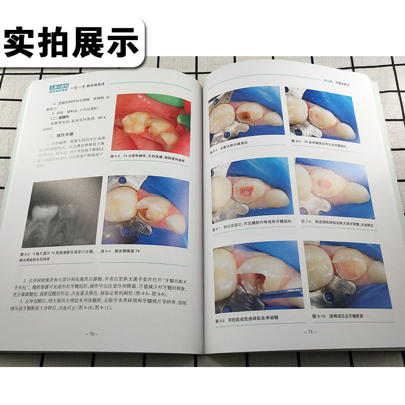 [正版] 儿童口腔科临床操作教程 一步一步教你做临床 彩图版 主编秦满 口腔疾病临床案例诊治教程 人民卫生出版社978