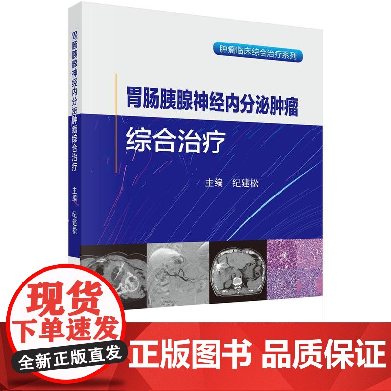 胃肠胰腺神经内分泌肿瘤综合治疗 纪建松 主编 适用肿瘤中心消化内科肝胆胰外科影像科胸外科疼痛科营养科专业医师 科学出版社高清大图