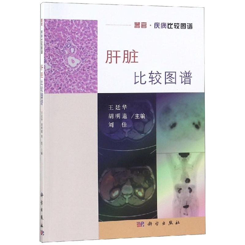 【M】肝脏比较图谱-9787030594556
