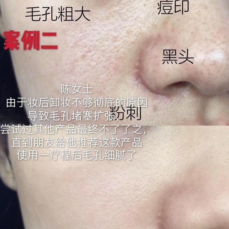 碧素堂撕拉面膜去黑头粉刺祛斑螨虫深层清洁控油角质祛痘保湿面膜快速