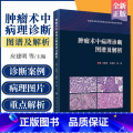 【正版】 肿瘤术中病理诊断图谱及解析 应建明 石素胜 杨琳 手术案例病理图片图谱病理学罕见病例诊断治疗肿瘤学冰冻切片