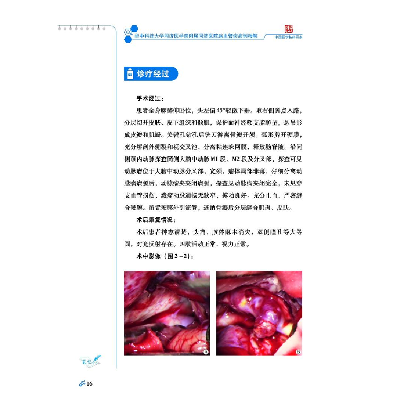 正版 脑血管病病例精解 张华楸舒凯 科学技术文献出版社 97875189高清大图