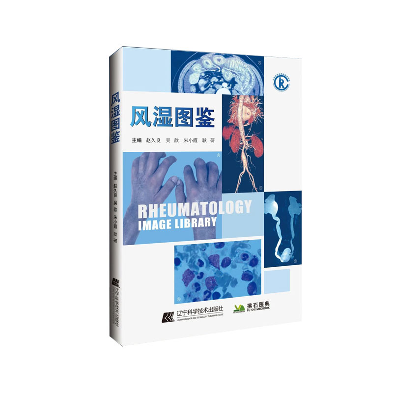 [醉染正版]风湿图鉴 赵久良 吴歆 朱小霞 耿研 风湿免疫病学临床图鉴图谱图谱病理学影像学检查诊断书籍风湿免疫科风湿病书高清大图