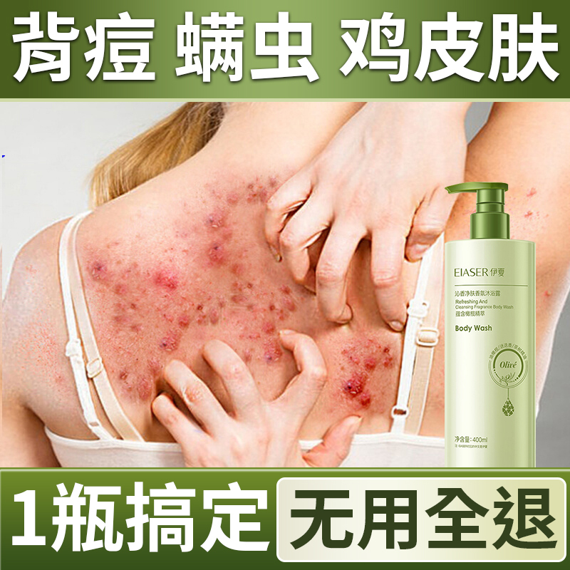 除螨沐浴露后背祛痘去鸡皮鸡皮男女持久留香皮官方正品品牌旗舰店