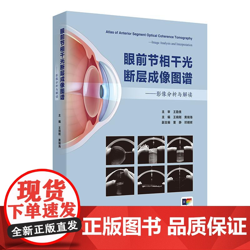 眼前节相干光断层成像图谱影像分析与解读OCT诊疗应用角膜屈光手术虹膜青光眼白内障超声乳化联合房角分离前房炎症晶状体前节光高清大图