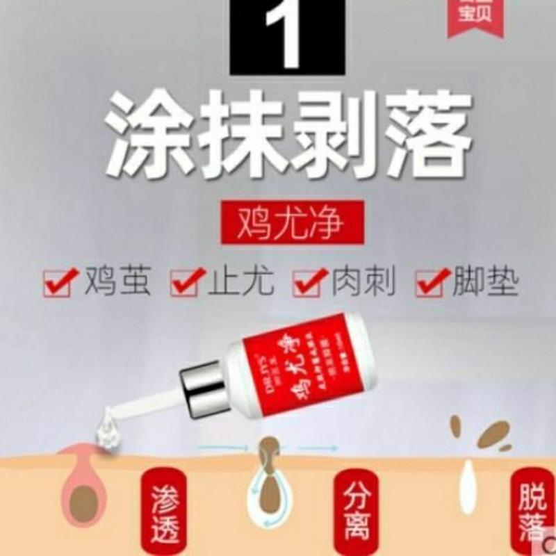 脚医生鸡尤净鸡眼膏贴鸡眼贴特效祛尤肉刺瘊子祛除寻常尤脚底疣 脚医生鸡尤净鸡眼膏贴鸡眼贴特效祛尤肉刺瘊子祛除寻常尤脚底疣