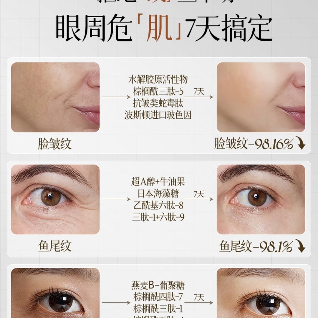儒意(RUYI)淡纹眼霜30g淡化细纹抗皱提拉紧致黑眼圈祛眼袋衰老30岁40岁以上高清大图
