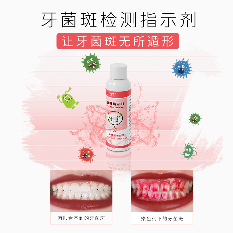 优利特牙菌斑显示剂牙菌斑指示剂牙菌斑漱口水型口腔菌斑显示片儿童成
